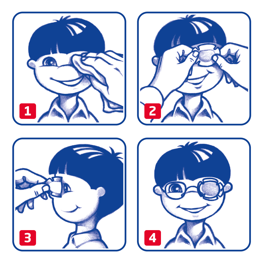 Eye occlusor by Leukoplast usage instructions Eye occlusor by Leukoplast usage instructions